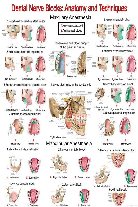 Dental Nerve Blocks: Anatomy & Techniques | High-Resolution Educational Poster