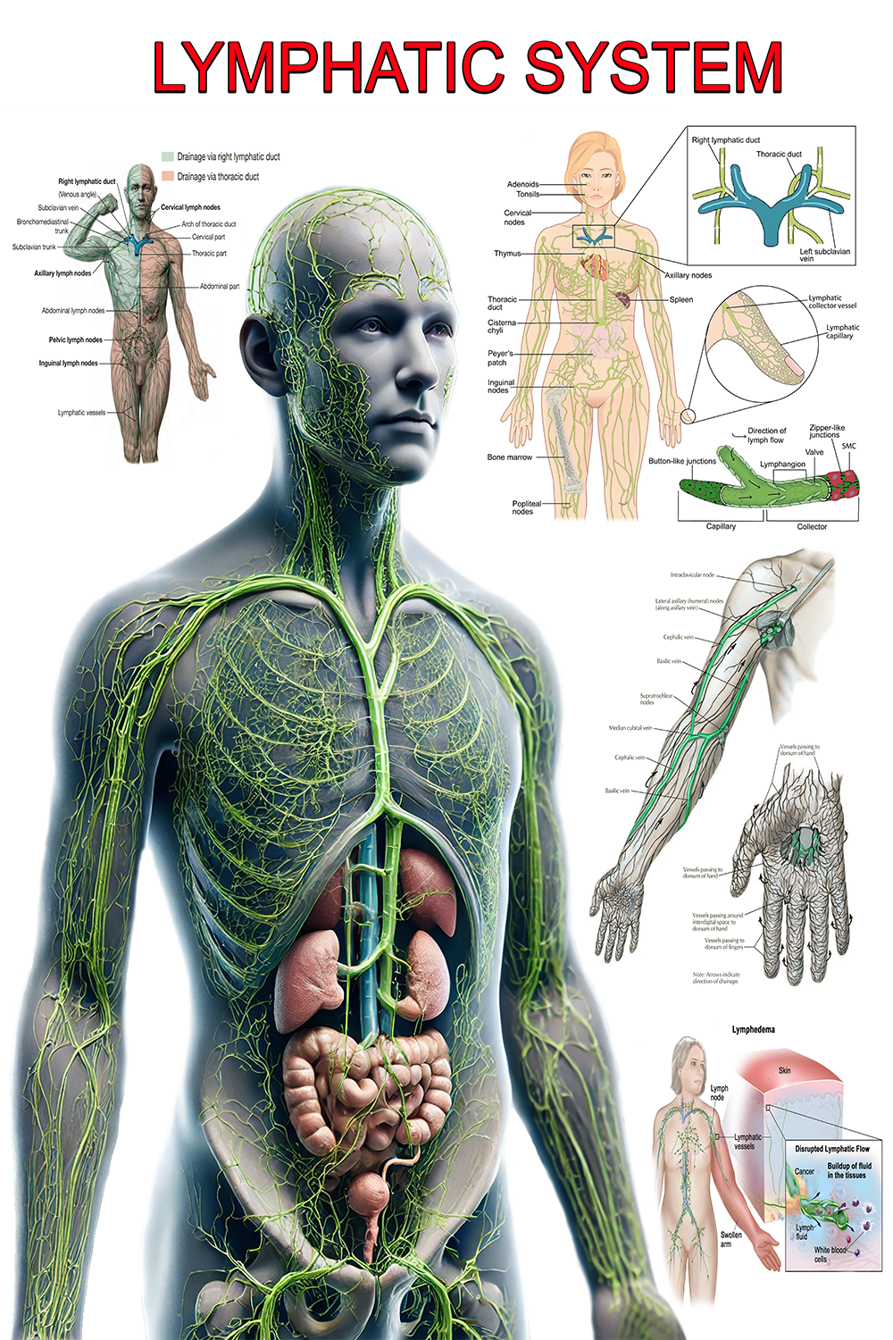 Lymphatic System Poster: Comprehensive Overview with Anatomy and Common Conditions - High-Resolution Poster