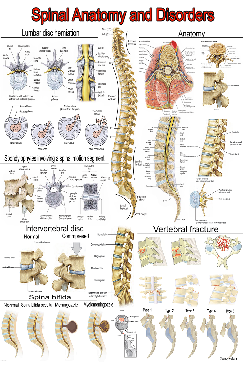 Spine Anatomy and Disorders: A Comprehensive Visual Guide | High-Resolution Educational Poster