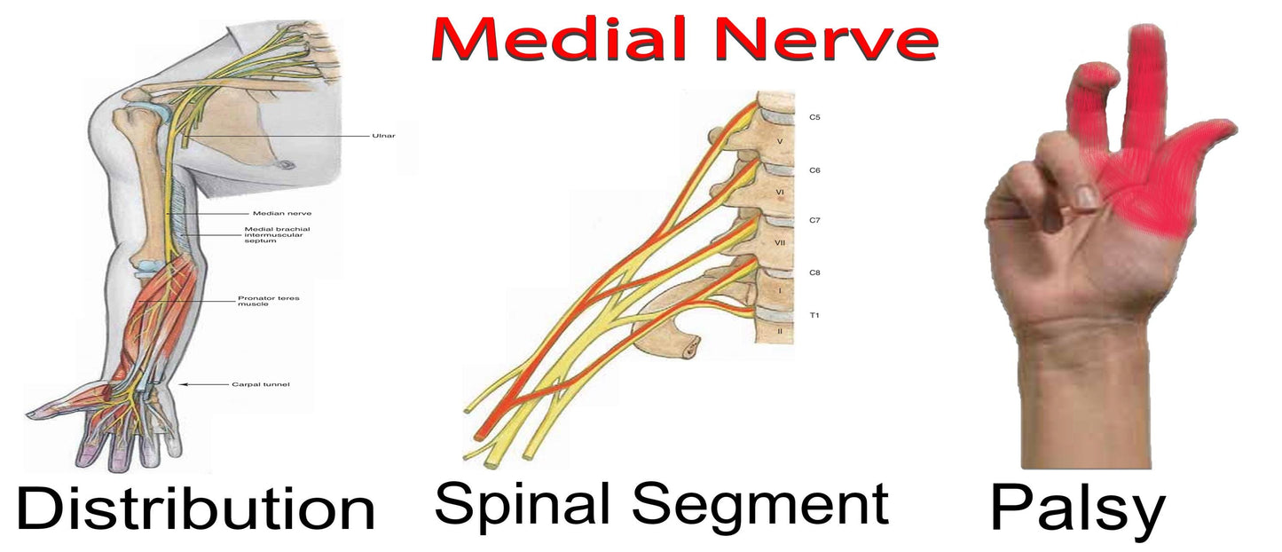 Nerves of the Arm: Distribution, Spinal Segment, and Palsy - High-Resolution Educational Chart