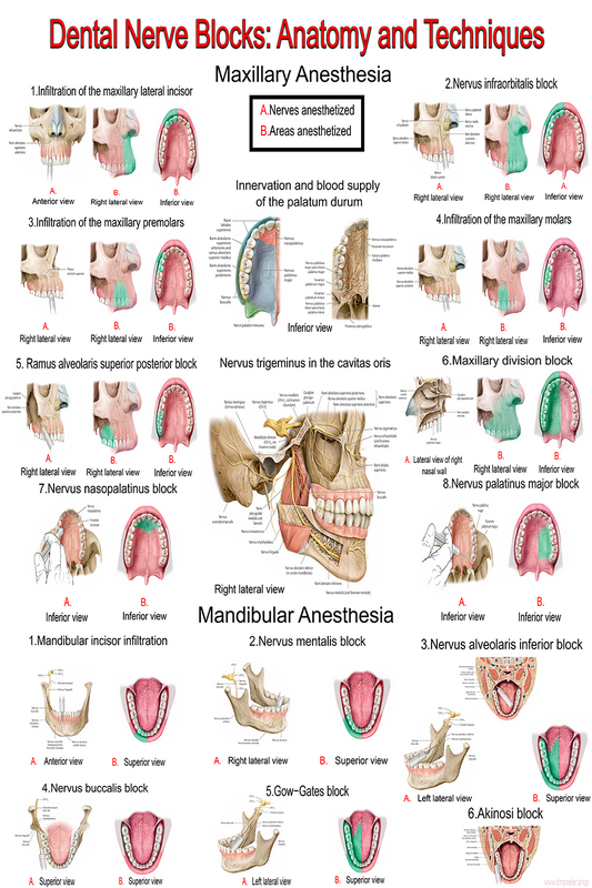 Dental Nerve Blocks: Anatomy & Techniques | High-Resolution PDF | Ready-to-Print Educational Poster