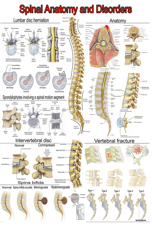 Spine Anatomy and Disorders: A Comprehensive Visual Guide | High-Resolution PDF | Ready-to-Print Educational Poster