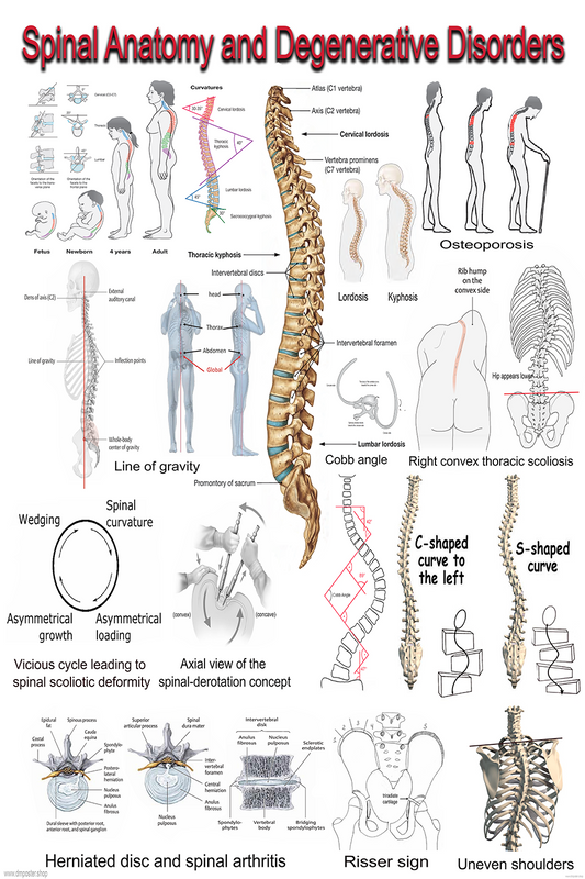 Spinal Anatomy and Degenerative Disorders – Medical Educational Poster